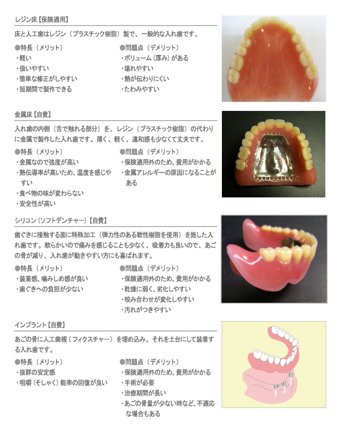 総入れ歯の種類
