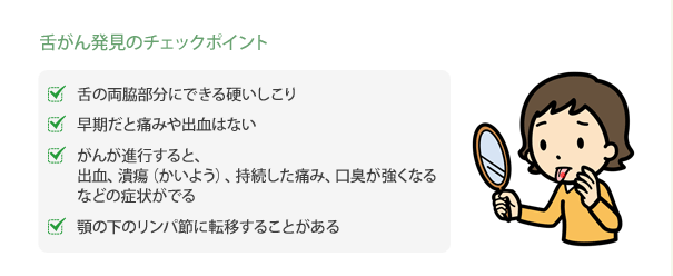 舌がん発見のチェックポイント