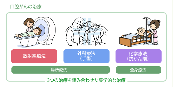 口腔がんの治療