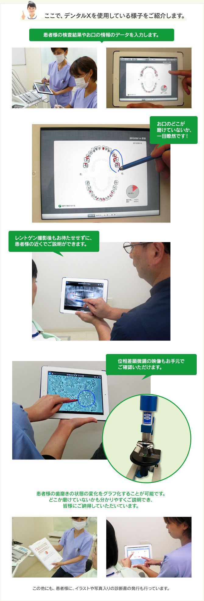 デンタルXを使用している様子