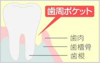 GTR法